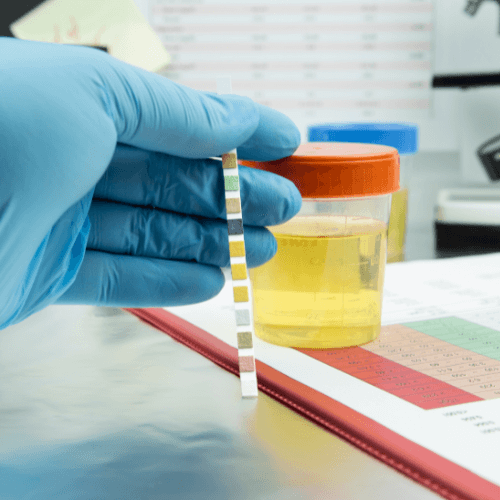 Wie lange ist ein Drogentest im Urin nachweisbar?
